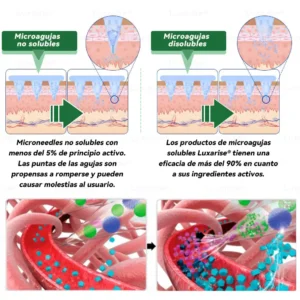 𝑻𝒊𝒆𝒏𝒅𝒂 𝑶𝒇𝒊𝒄𝒊𝒂𝒍  | 🌼💖𝑳𝒖𝒙𝒂𝒓𝒊𝒔𝒆® 10 𝑬𝑵 1 𝑴𝒐𝒓𝒊𝒏𝒈𝒂 𝒀 𝑩𝒆𝒓𝒃𝒆𝒓𝒊𝒏𝒂 𝑷𝒂𝒓𝒄𝒉𝒆 𝑨𝒗𝒂𝒏𝒛𝒂𝒅𝒐 𝑫𝒆 𝑴𝒊𝒄𝒓𝒐𝒏𝒆𝒆𝒅𝒍𝒆𝒔 𝑵𝒂𝒏𝒐（𝑼𝒏𝒂 𝒗𝒆𝒛 𝒂𝒍 𝒅í𝒂, 𝒄𝒂𝒎𝒃𝒊𝒐𝒔 𝒗𝒊𝒔𝒊𝒃𝒍𝒆𝒔 𝒆𝒏 7 𝒅í𝒂𝒔）  𝑶𝒃𝒆𝒔𝒊𝒅𝒂𝒅, 𝑫𝒊𝒂𝒃𝒆𝒕𝒆𝒔, 𝑨𝒑𝒏𝒆𝒂 𝒅𝒆𝒍 𝑺𝒖𝒆ñ𝒐 𝒚 𝑷𝒓𝒐𝒃𝒍𝒆𝒎𝒂𝒔 𝑨𝒓𝒕𝒊𝒄𝒖𝒍𝒂𝒓𝒆𝒔