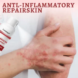 OFFICIAL
        BRAND
      
    
    
    
      𝗟𝘂𝘅𝗮𝗿𝗶𝘀𝒆® 𝗦𝗻𝗮𝗶𝗹 𝗠𝘂𝗰𝗶𝗻 𝗛𝗲𝗮𝗹𝗶𝗻𝗴 𝗦𝗽𝗿𝗮𝘆 – 𝗥𝗲𝗹𝗶𝗲𝗳 𝗳𝗼𝗿 𝗦𝗲𝗻𝘀𝗶𝘁𝗶𝘃𝗲 & 𝗙𝗹𝗮𝗿𝗲-𝗨𝗽 𝗦𝗸𝗶𝗻 ✨