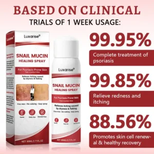 OFFICIAL
        BRAND
      
    
    
    
      𝗟𝘂𝘅𝗮𝗿𝗶𝘀𝒆® 𝗦𝗻𝗮𝗶𝗹 𝗠𝘂𝗰𝗶𝗻 𝗛𝗲𝗮𝗹𝗶𝗻𝗴 𝗦𝗽𝗿𝗮𝘆 – 𝗥𝗲𝗹𝗶𝗲𝗳 𝗳𝗼𝗿 𝗦𝗲𝗻𝘀𝗶𝘁𝗶𝘃𝗲 & 𝗙𝗹𝗮𝗿𝗲-𝗨𝗽 𝗦𝗸𝗶𝗻 ✨