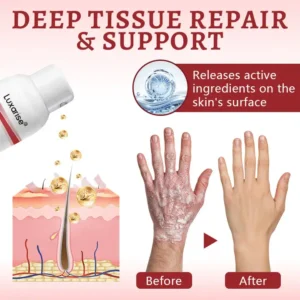 OFFICIAL
        BRAND
      
    
    
    
      𝗟𝘂𝘅𝗮𝗿𝗶𝘀𝒆® 𝗦𝗻𝗮𝗶𝗹 𝗠𝘂𝗰𝗶𝗻 𝗛𝗲𝗮𝗹𝗶𝗻𝗴 𝗦𝗽𝗿𝗮𝘆 – 𝗥𝗲𝗹𝗶𝗲𝗳 𝗳𝗼𝗿 𝗦𝗲𝗻𝘀𝗶𝘁𝗶𝘃𝗲 & 𝗙𝗹𝗮𝗿𝗲-𝗨𝗽 𝗦𝗸𝗶𝗻 ✨