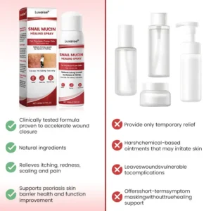 OFFICIAL
        BRAND
      
    
    
    
      𝗟𝘂𝘅𝗮𝗿𝗶𝘀𝒆® 𝗦𝗻𝗮𝗶𝗹 𝗠𝘂𝗰𝗶𝗻 𝗛𝗲𝗮𝗹𝗶𝗻𝗴 𝗦𝗽𝗿𝗮𝘆 – 𝗥𝗲𝗹𝗶𝗲𝗳 𝗳𝗼𝗿 𝗦𝗲𝗻𝘀𝗶𝘁𝗶𝘃𝗲 & 𝗙𝗹𝗮𝗿𝗲-𝗨𝗽 𝗦𝗸𝗶𝗻 ✨