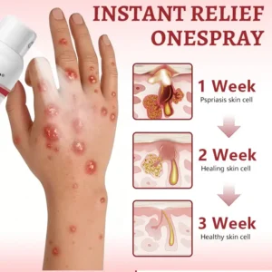 OFFICIAL
        BRAND
      
    
    
    
      𝗟𝘂𝘅𝗮𝗿𝗶𝘀𝒆® 𝗦𝗻𝗮𝗶𝗹 𝗠𝘂𝗰𝗶𝗻 𝗛𝗲𝗮𝗹𝗶𝗻𝗴 𝗦𝗽𝗿𝗮𝘆 – 𝗥𝗲𝗹𝗶𝗲𝗳 𝗳𝗼𝗿 𝗦𝗲𝗻𝘀𝗶𝘁𝗶𝘃𝗲 & 𝗙𝗹𝗮𝗿𝗲-𝗨𝗽 𝗦𝗸𝗶𝗻 ✨