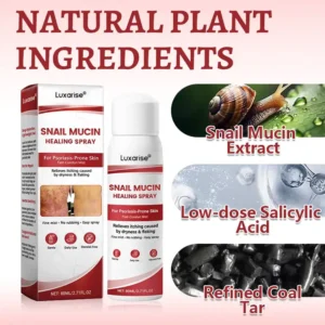 OFFICIAL
        BRAND
      
    
    
    
      𝗟𝘂𝘅𝗮𝗿𝗶𝘀𝒆® 𝗦𝗻𝗮𝗶𝗹 𝗠𝘂𝗰𝗶𝗻 𝗛𝗲𝗮𝗹𝗶𝗻𝗴 𝗦𝗽𝗿𝗮𝘆 – 𝗥𝗲𝗹𝗶𝗲𝗳 𝗳𝗼𝗿 𝗦𝗲𝗻𝘀𝗶𝘁𝗶𝘃𝗲 & 𝗙𝗹𝗮𝗿𝗲-𝗨𝗽 𝗦𝗸𝗶𝗻 ✨