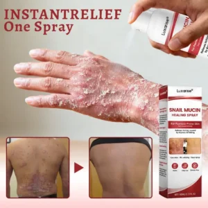 OFFICIAL
        BRAND
      
    
    
    
      𝗟𝘂𝘅𝗮𝗿𝗶𝘀𝒆® 𝗦𝗻𝗮𝗶𝗹 𝗠𝘂𝗰𝗶𝗻 𝗛𝗲𝗮𝗹𝗶𝗻𝗴 𝗦𝗽𝗿𝗮𝘆 – 𝗥𝗲𝗹𝗶𝗲𝗳 𝗳𝗼𝗿 𝗦𝗲𝗻𝘀𝗶𝘁𝗶𝘃𝗲 & 𝗙𝗹𝗮𝗿𝗲-𝗨𝗽 𝗦𝗸𝗶𝗻 ✨